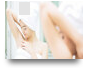 laser hair removal